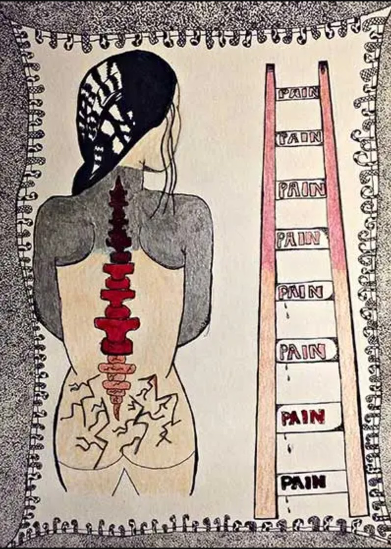 Bearing Chronic Pain: What Can Art Offer? by Eva Tordera Nuño